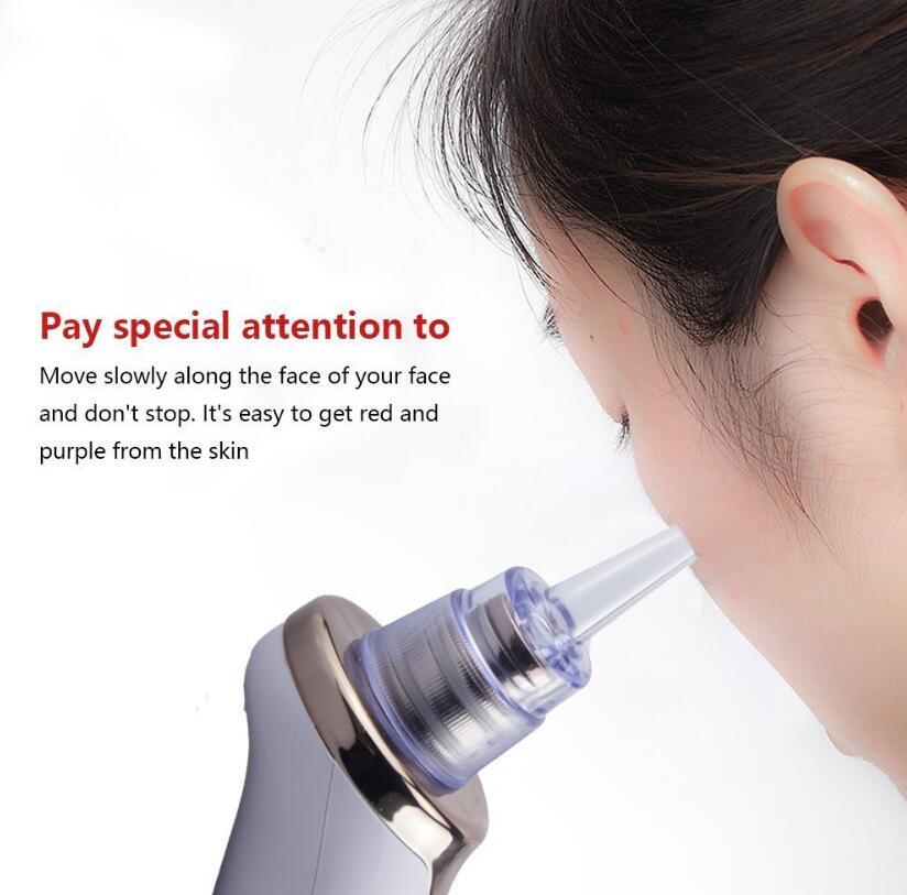 Electric Blackhead Remover – Facial Pore Cleaner & Acne Suction Tool