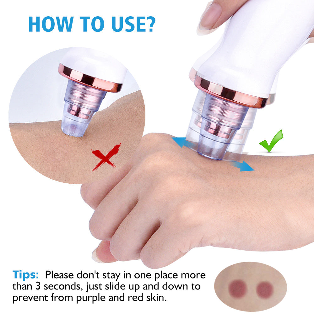 Electric Blackhead Remover – Facial Pore Cleaner & Acne Suction Tool