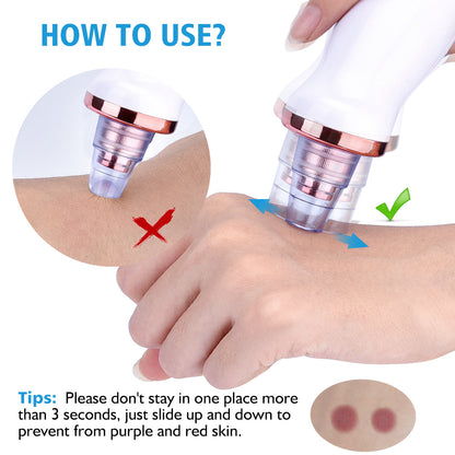 Electric Blackhead Remover – Facial Pore Cleaner & Acne Suction Tool