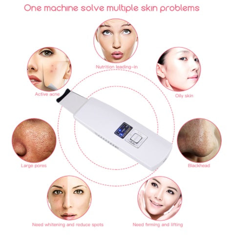 Ultrasonic Skin Scrubber – Blackhead & Acne Removal Facial Cleanser