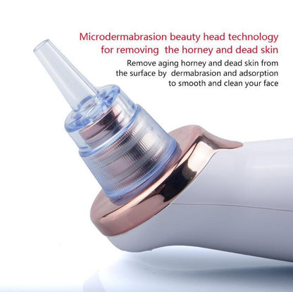Electric Blackhead Remover – Facial Pore Cleaner & Acne Suction Tool