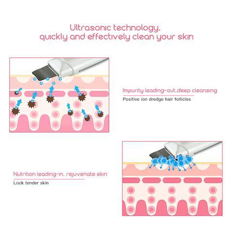 Ultrasonic Skin Scrubber – Blackhead & Acne Removal Facial Cleanser