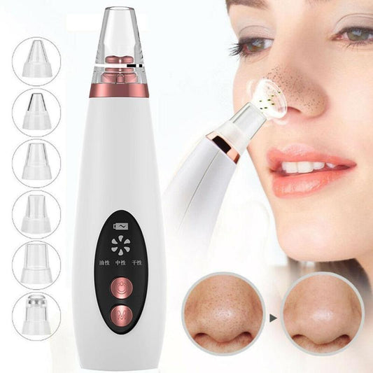 Blackhead Remover & Pore Vacuum – Deep Face Cleansing Tool